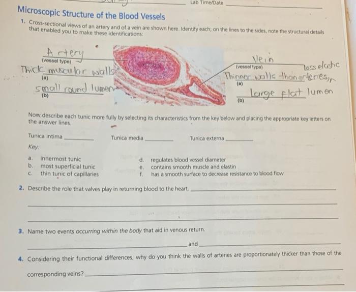 Cross sectional views of an artery and of a vein