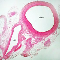 Vein artery veins arteries heart comparison structure between system difference cardiovascular walls provides below