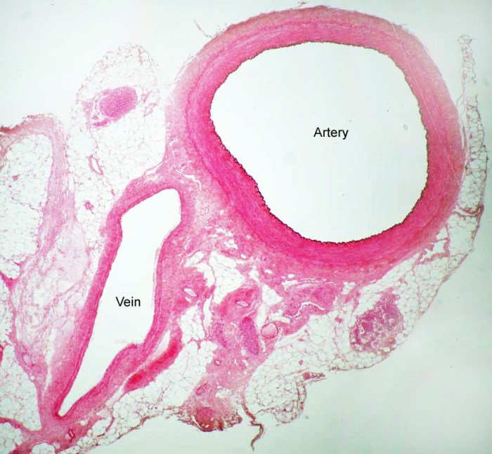 Vein artery veins arteries heart comparison structure between system difference cardiovascular walls provides below